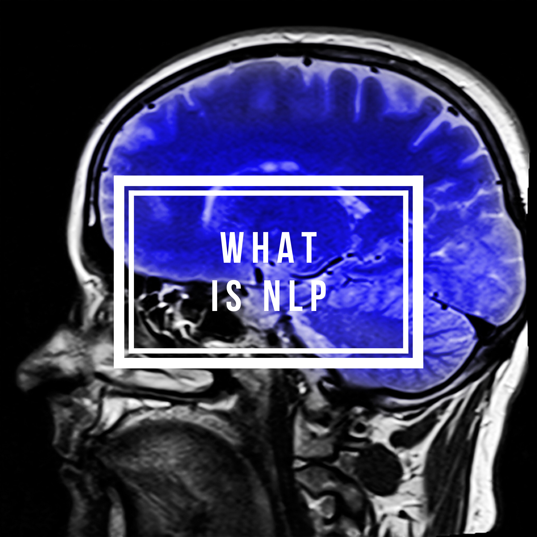 What is NLP?